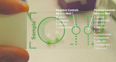 肠球菌公元前快速分子诊断试验