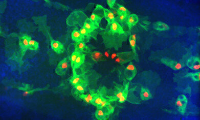 细胞凋亡过程被发现破坏免疫细胞功能