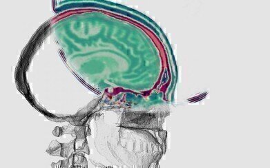 地球成像技术转换成详细的脑成像技术