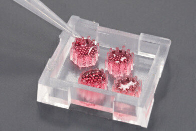 器官模型预示着第一个PDAC见解早期诊断