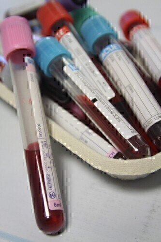 当前预防与共同相关感染的计划是否足够？