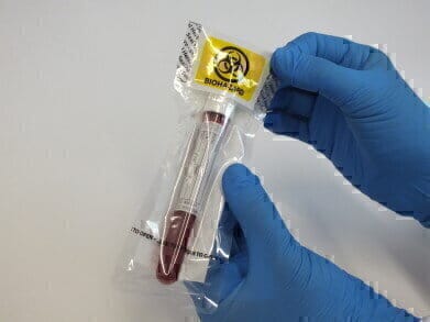 减少一次性塑料的体积在医疗保健