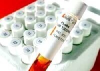 Cod测试现在适用于所有仪器