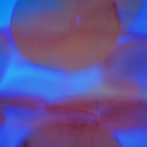 Anti-fibrotic治疗青光眼的新方法